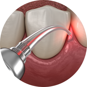 Koukoudetsos-Laser-Assisted-Dentistry